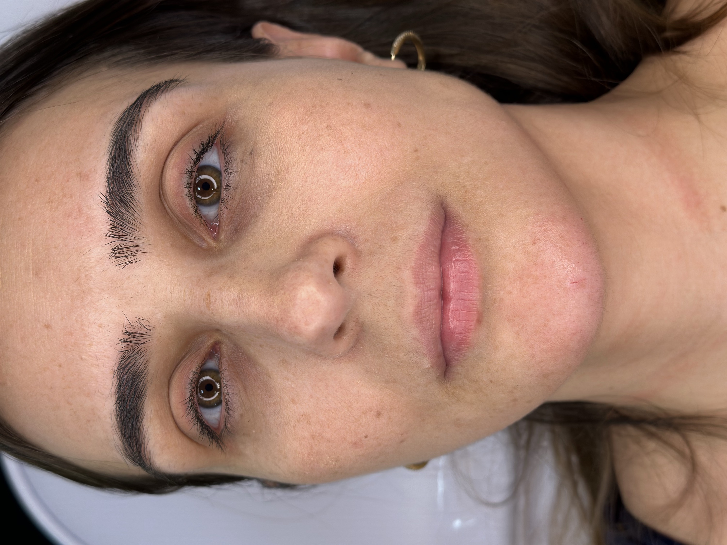 Antes do preenchimento labial, rosto frontal e lábios naturais