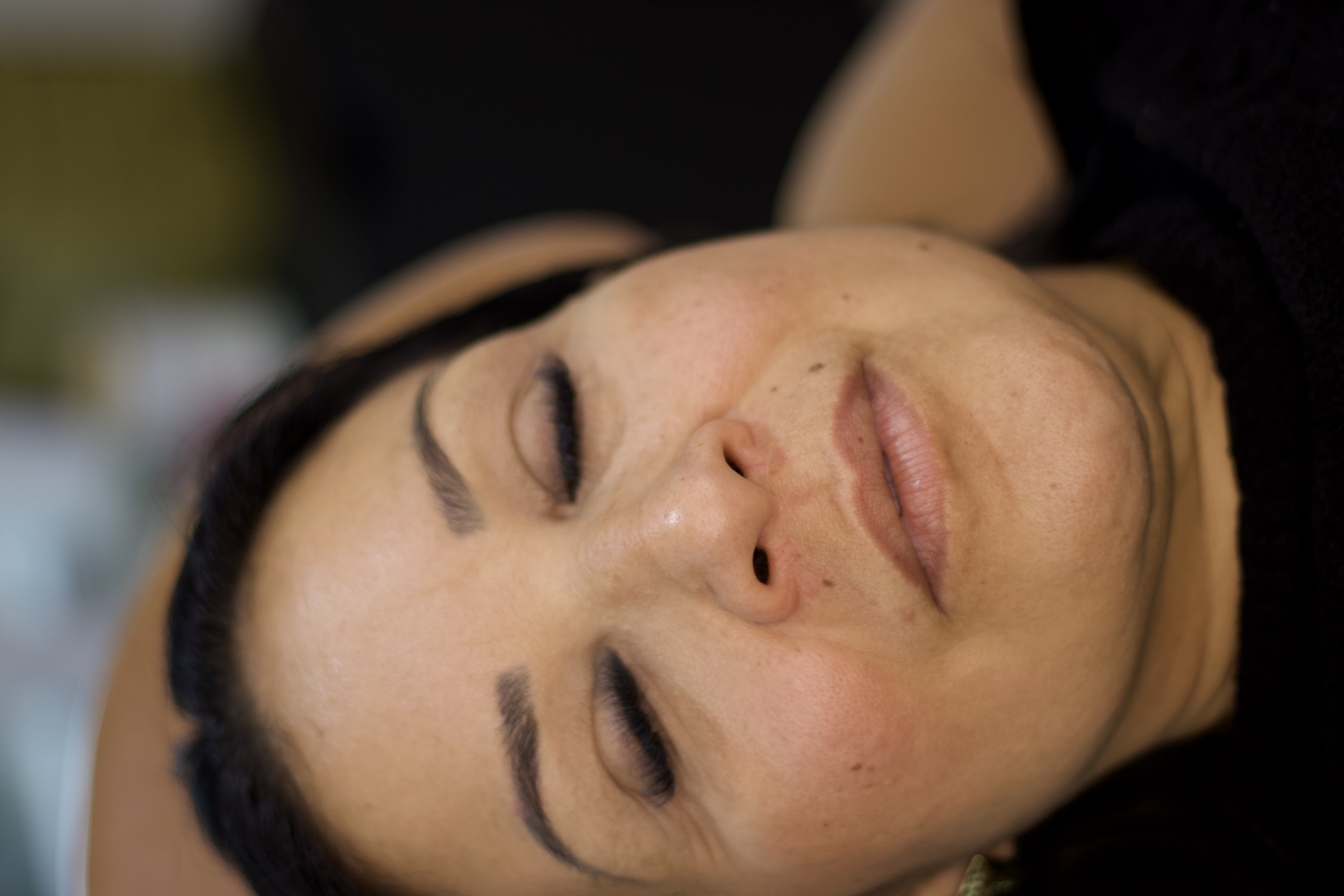 Antes do preenchimento labial, rosto frontal reclinado