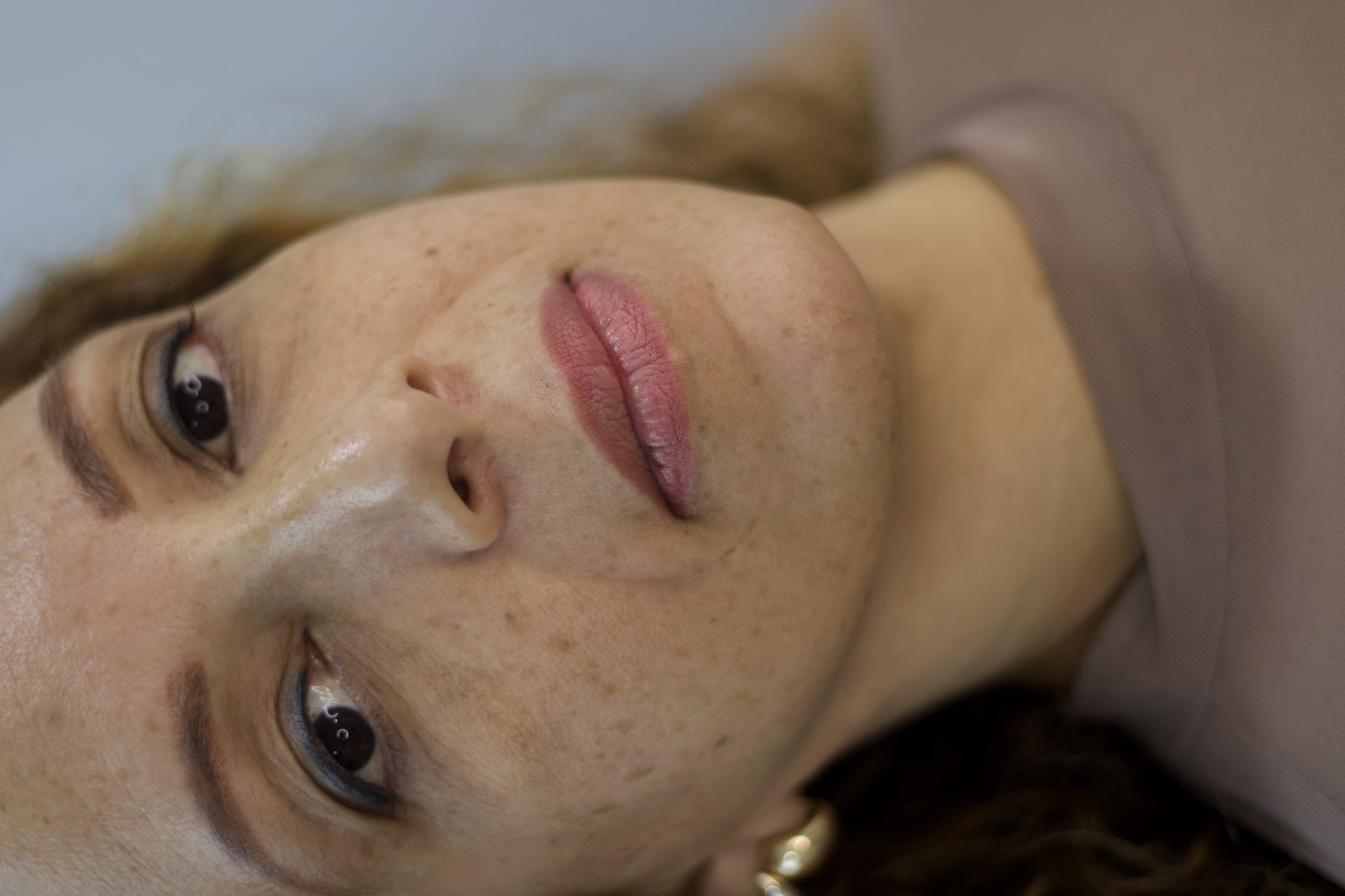 Antes do preenchimento labial, rosto em ângulo três quartos